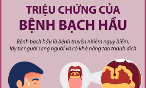 Triệu chứng của bệnh bạch hầu