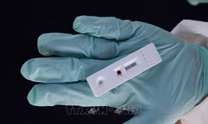 Trung Quốc cho phép bán đại trà kit test nhanh COVID-19