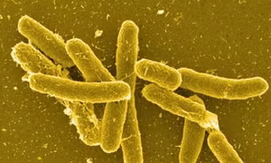 Malaysia thu hồi lô bơ đậu phộng nhập khẩu từ Mỹ nghi nhiễm khuẩn salmonella