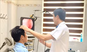 Cấp cứu thành công bệnh nhân bị mũi khoan thép đâm xuyên hốc mũi
