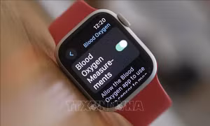 Cơ quan Hải quan Mỹ gặp rắc rối vì cho phép nhập khẩu Apple Watch