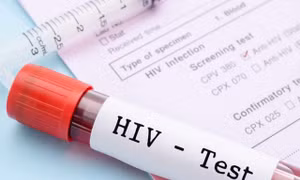 Thêm hy vọng về khả năng chữa khỏi bệnh HIV/AIDS