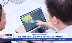 Định vị phẫu thuật – Bước tiến chính xác trong điều trị răng hàm mặt