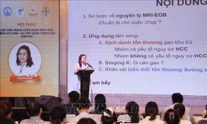 Cập nhật ứng dụng kỹ thuật mới chẩn đoán sớm ung thư gan