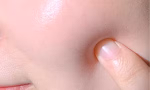Giải pháp giúp kéo dài tuổi thọ làn da