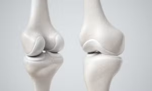 Phát triển sụn khớp nhân tạo có tính ứng dụng cao