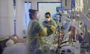 Phát hiện nguyên nhân gây tổn thương phổi ở người mắc COVID-19