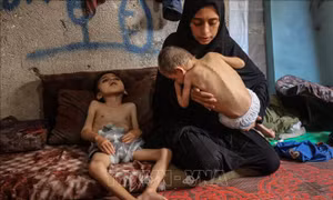 Gần 13.000 trẻ em Gaza phải điều trị suy dinh dưỡng khi viện trợ vẫn nhỏ giọt