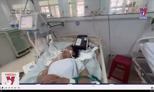 Nguyên nhân gây ra chùm ca ngộ độc botulinum