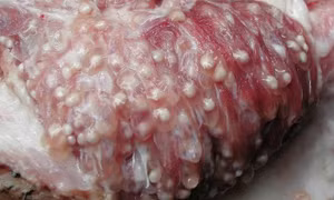 Sán lợn là bệnh thường gặp
