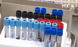 10 người điều trị phơi nhiễm HIV do bị kẻ lạ đâm