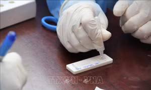 Đính chính thông tin số ca lây nhiễm tại Hà Nội đang gây hoang mang dư luận