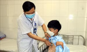 Cảnh giác dịch sởi lây lan