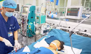 Bị ong đốt hơn 100 nốt, bé trai 10 tuổi tử vong do bị suy đa tạng, rối loạn đông máu