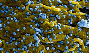 CDC Mỹ cảnh báo nguy cơ virus Marburg lây lan từ châu Phi