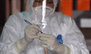 Hà Nội hỗ trợ 100% chi phí xét nghiệm sàng lọc SARS-CoV-2 theo hướng dẫn của Bộ Y tế