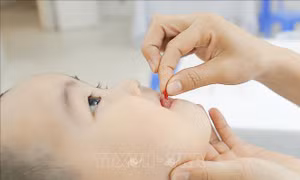 Bộ Y tế chỉ đạo việc sử dụng vitamin A trong điều trị bệnh sởi
