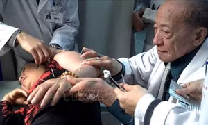 Một vài kỷ niệm với GS. Nguyễn Tài Thu - người có đôi ‘bàn tay vàng’ châm cứu của Việt Nam