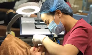  Cách chăm sóc da đúng và đủ để ngừa mụn trứng cá ở tuổi dậy thì