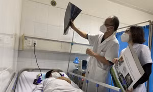 Cảnh báo liên tục, vẫn nhiều người bị tai biến do tiêm filler làm đẹp trôi nổi