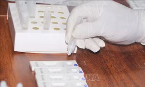 Kết quả test nhanh COVID-19 tại nhà chỉ để người dân tự kiểm tra