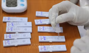 Xét nghiệm sàng lọc ca nhiễm SARS-CoV-2. Ảnh: TTXVN.