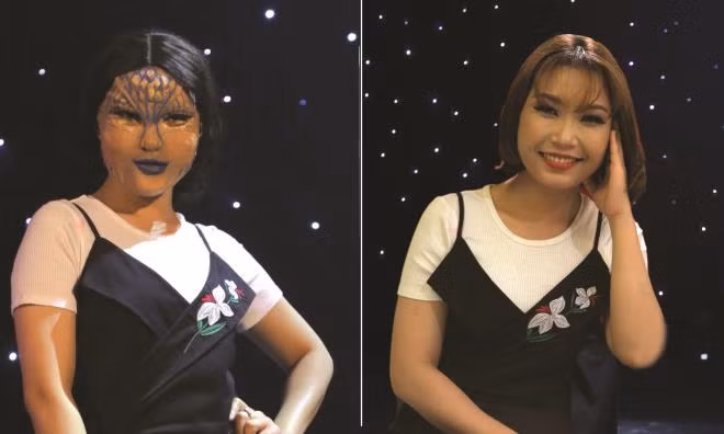 'Lựa chọn của trái tim': Anh chàng thất tình 7 năm bén duyên cô nàng yêu đơn phương từ 15 tuổi ảnh 2
