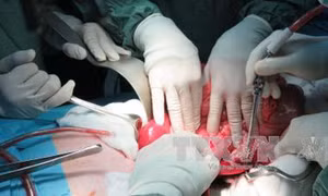 Ghép thận thành công cho bé trai suy thận giai đoạn cuối có đột biến gen