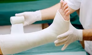 Mùa hè gia tăng trẻ bị thương tích, chăm sóc trẻ bó bột tại nhà như thế nào?