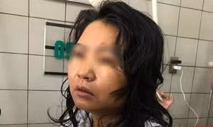 Hôn mê, nguy kịch vì thực phẩm chức năng giảm cân?