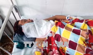 Nhuộm tóc đỏ, hai thanh niên bị dội xăng đốt bỏng nặng