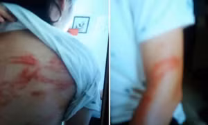 Hai cháu bé ở Hà Nội bị bố bạo hành đang ở nhà bác ruột