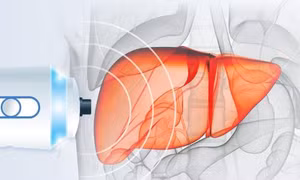 Phát hiện hợp chất có nguồn gốc vitamin có thể ngăn ung thư gan tái phát