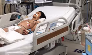 Một bệnh nhi nhiễm vi khuẩn tụ cầu vàng sau cú ngã xe đạp 