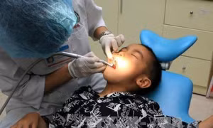 Cách chăm sóc phòng bệnh sâu răng cho trẻ