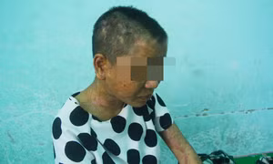 Cố ý gây thương tích cho người làm công bị xử phạt như thế nào?