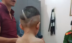 Cháu bé 3 tuổi bị cha dượng bạo hành: Mức phạt cao nhất cho kẻ phạm tội có thể là 7 năm tù