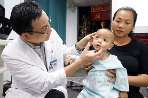 Bé trai viêm xoang gây biến chứng áp xe mắt khổng lồ ảnh 1