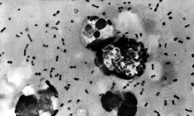 Vi khuẩn Yersinia pestis gây bệnh dịch hạch, trong đó phổ biến nhất là dịch hạch thể hạch, thường lây truyền qua vết cắn của bọ chét nhiễm bệnh. Ảnh: Trung tâm Kiểm soát và Phòng ngừa Dịch bệnh Mỹ