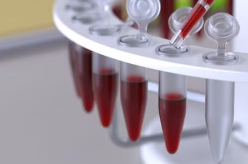 Phương pháp phát hiện virus đã phơi nhiễm trong nhiều năm ảnh 1