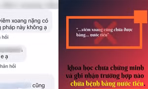 Chữa đau mắt đỏ bằng nước tiểu: Cẩn thận 'mang tật' vào người