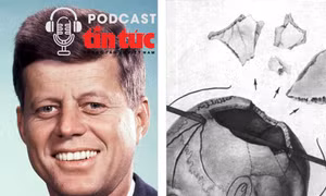 Hồ sơ mật: Bí ẩn bộ não biến mất của cựu Tổng thống Mỹ Kennedy
