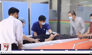 Đột quỵ não: Ít bệnh nhân được cấp cứu trong giờ vàng